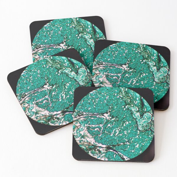 Item preview, Histology of fibroadipose, human tissue, Grocott green, 20x designed and sold by Psymier.