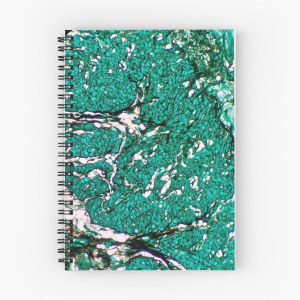 Item preview, Histology of fibroadipose, human tissue, Grocott green, 20x designed and sold by Psymier.
