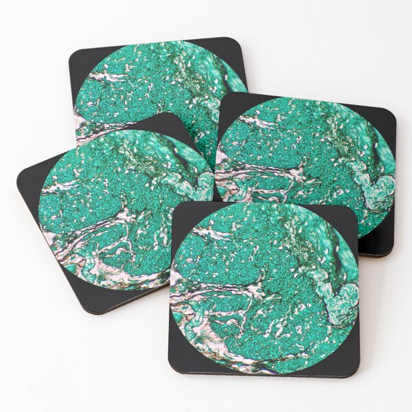 Item preview, Histology of fibrous tissue, fibroadipose, human tissue, Grocott green, 20x designed and sold by Psymier.