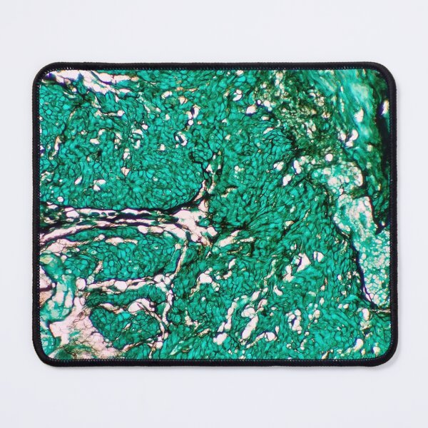 Item preview, Histology of fibrous tissue, fibroadipose, human tissue, Grocott green, 20x designed and sold by Psymier.