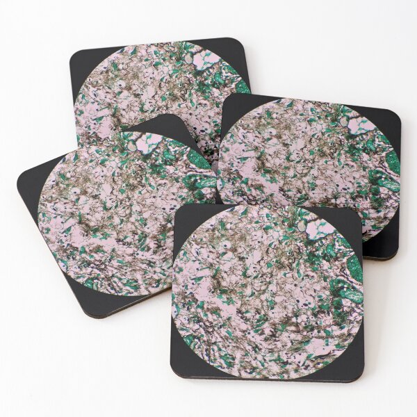 Item preview, Histology of fibrous tissue, fibroadipose, human tissue, Grocott green, 40x designed and sold by Psymier.