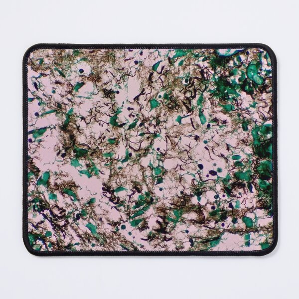 Item preview, Histology of fibrous tissue, fibroadipose, human tissue, Grocott green, 40x designed and sold by Psymier.