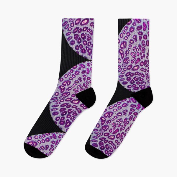 Item preview, Histology of stomach pits, glands, human tissue, AB/PAS, 20x designed and sold by Psymier.