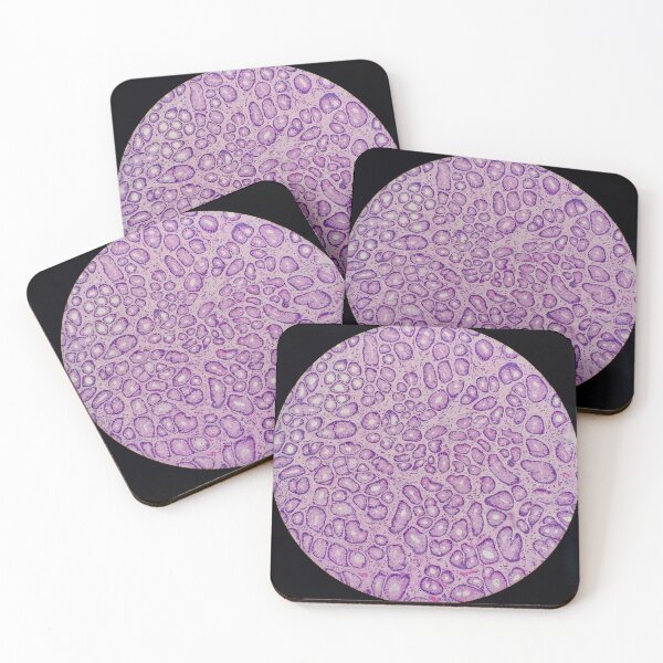 Item preview, Histology of stomach pits, glands, human tissue, H&E, 20x designed and sold by Psymier.