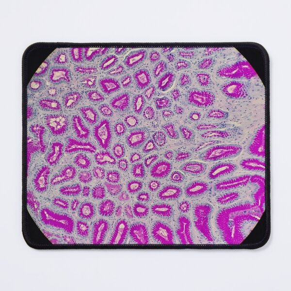 Item preview, Stomach histology, PAS stain, 20x designed and sold by Psymier.