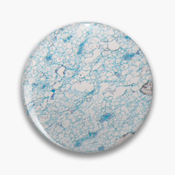 Item preview, Cells of a corn plant with a infection of the plant pathogen Ustilago maydis under the microscope designed and sold by Zosimus.