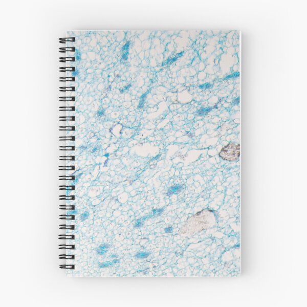 Item preview, Cells of a corn plant with a infection of the plant pathogen Ustilago maydis under the microscope designed and sold by Zosimus.