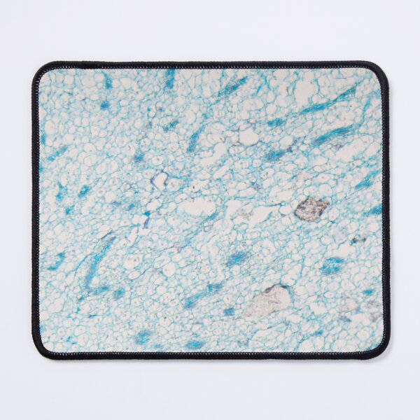 Item preview, Cells of a corn plant with a infection of the plant pathogen Ustilago maydis under the microscope designed and sold by Zosimus.