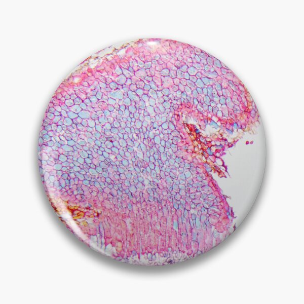 Item preview,  Black rust, puccinia graminis, on a barberry leaf under the microscope designed and sold by Zosimus.
