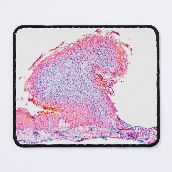 Item preview, Black rust, puccinia graminis, on a barberry leaf under the microscope designed and sold by Zosimus.