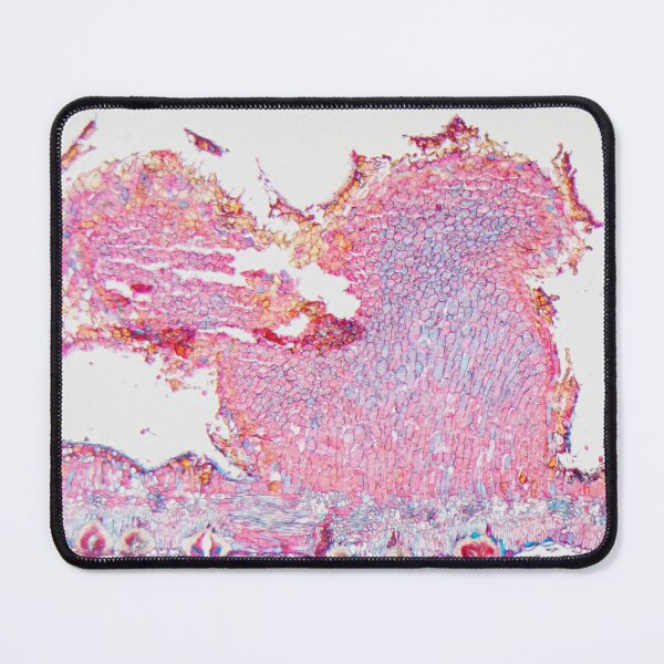 Item preview,  Black rust, puccinia graminis, on a barberry leaf under the microscope designed and sold by Zosimus.