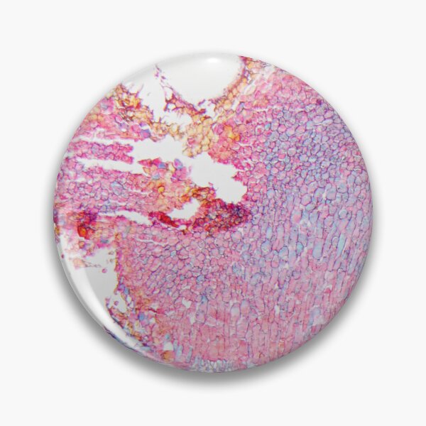 Item preview,  Black rust, puccinia graminis, on a barberry leaf under the microscope designed and sold by Zosimus.