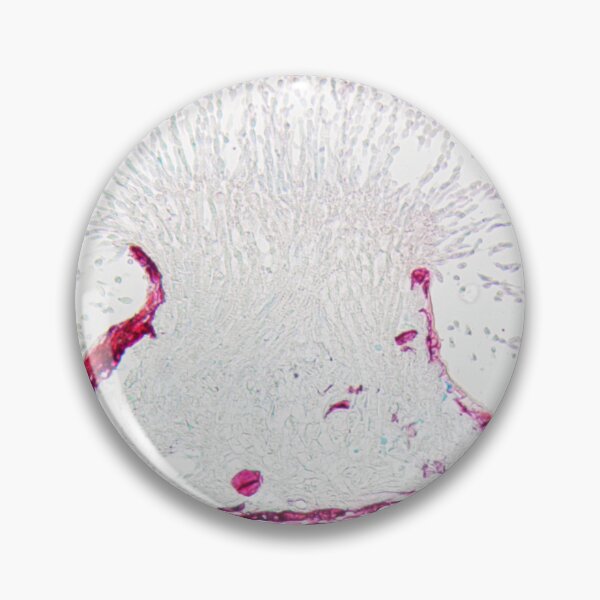 Item preview, Monilinia fructigena under the microscope designed and sold by Zosimus.