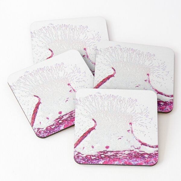 Item preview, Monilinia fructigena under the microscope designed and sold by Zosimus.