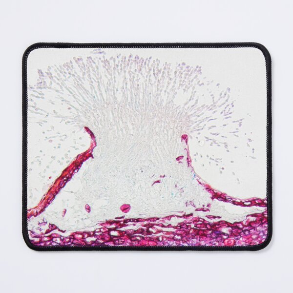 Item preview, Monilinia fructigena under the microscope designed and sold by Zosimus.