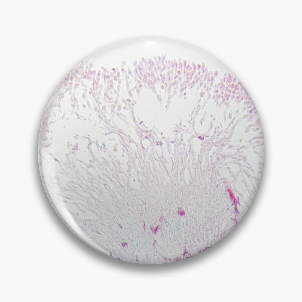 Item preview, The plant pathogen Monilinia fructigena under the microscope designed and sold by Zosimus.