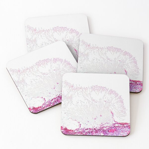 Item preview, The plant pathogen Monilinia fructigena under the microscope designed and sold by Zosimus.