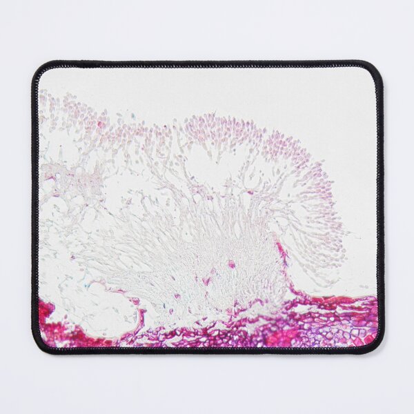 Item preview, The plant pathogen Monilinia fructigena under the microscope designed and sold by Zosimus.
