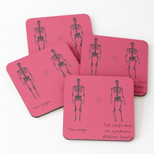 Item preview, Skeleton with Ehlers-Danlos syndrome designed and sold by maviedezebre.