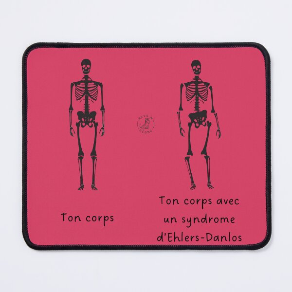 Item preview, Skeleton with Ehlers-Danlos syndrome designed and sold by maviedezebre.