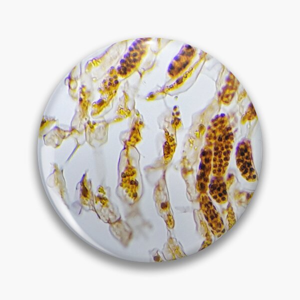 Item preview, brown alga Fucus sporangia, live specimen; plant anatomy, microscopy designed and sold by everydaybotany.
