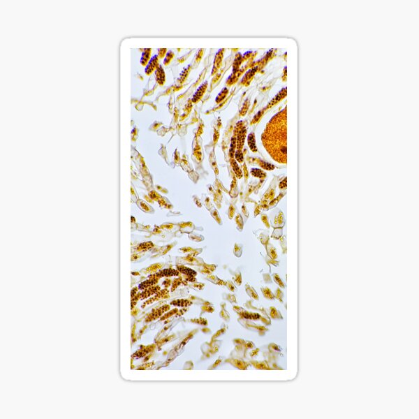 Item preview, brown alga Fucus sporangia, live specimen; plant anatomy, microscopy designed and sold by everydaybotany.