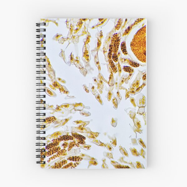 Item preview, brown alga Fucus sporangia, live specimen; plant anatomy, microscopy designed and sold by everydaybotany.
