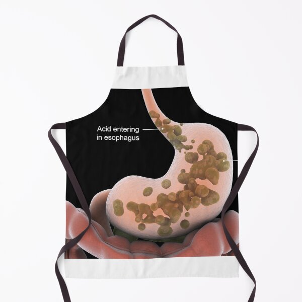 Item preview, STK701293H-Acid reflux in the stomach. designed and sold by StocktrekImages.
