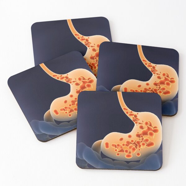Item preview, STK701294H-Acid reflux in human stomach. designed and sold by StocktrekImages.