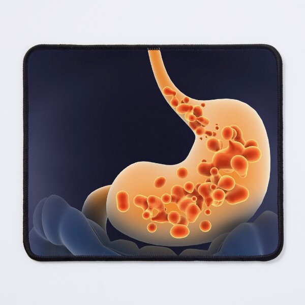 Item preview, STK701294H-Acid reflux in human stomach. designed and sold by StocktrekImages.