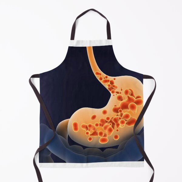 Item preview, STK701294H-Acid reflux in human stomach. designed and sold by StocktrekImages.