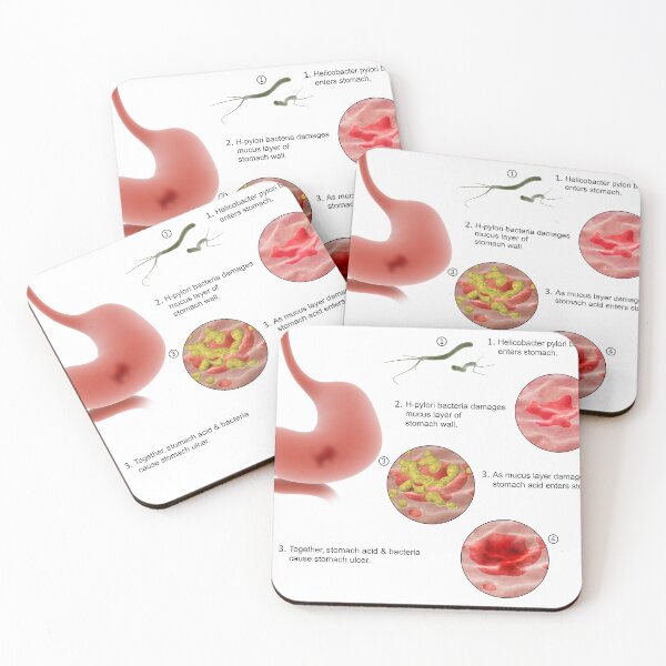 Item preview, STK701298H-Helicobacter pylori bacteria entering the stomach and causing ulcers. designed and sold by StocktrekImages.