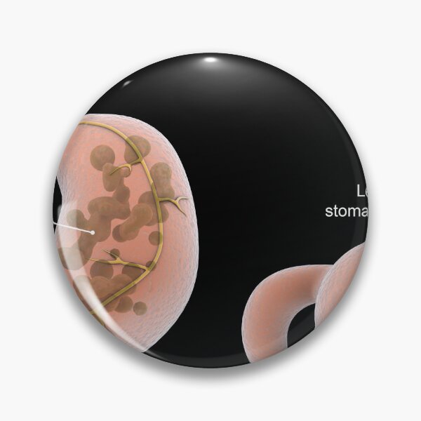 Item preview, STK701300H-Vagotomy surgical procedure to remove part of the vagus nerve. designed and sold by StocktrekImages.