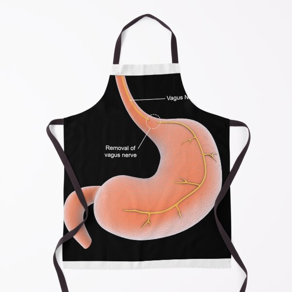 Item preview, STK701301H-Vagotomy surgical procedure to remove part of the vagus nerve. designed and sold by StocktrekImages.