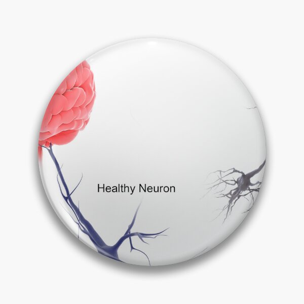 Item preview, STK701304H-A healthy brain compared to a brain with alzheimer's. designed and sold by StocktrekImages.