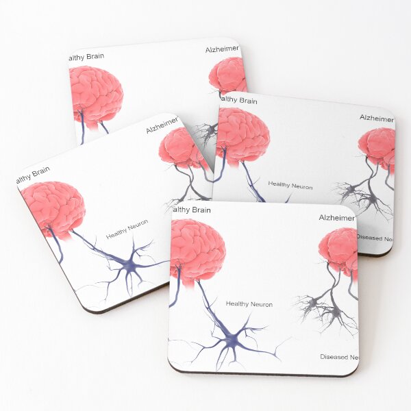 Item preview, STK701304H-A healthy brain compared to a brain with alzheimer's. designed and sold by StocktrekImages.