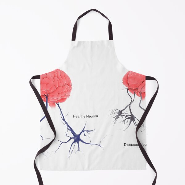 Item preview, STK701304H-A healthy brain compared to a brain with alzheimer's. designed and sold by StocktrekImages.