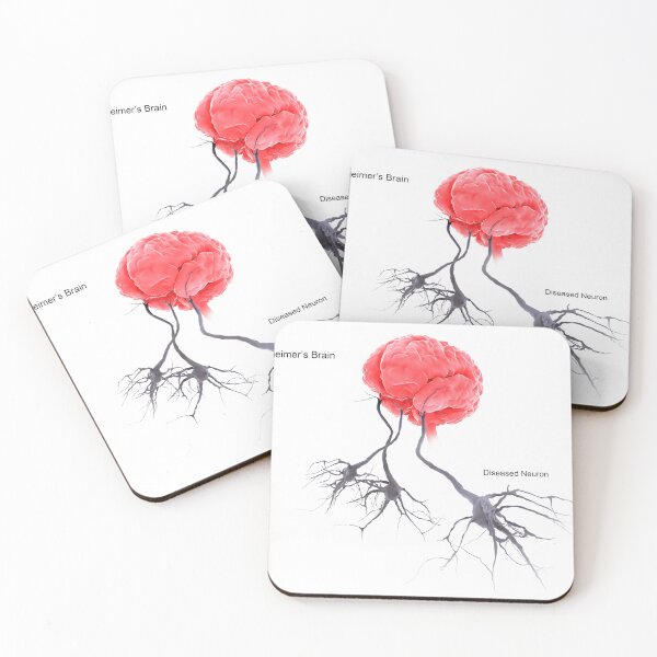 Item preview, STK701305H-A brain with alzheimer's disease, showing diseased neuron. designed and sold by StocktrekImages.
