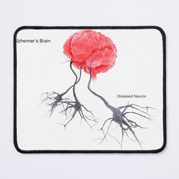 Item preview, STK701305H-A brain with alzheimer's disease, showing diseased neuron. designed and sold by StocktrekImages.
