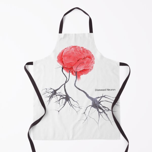 Item preview, STK701305H-A brain with alzheimer's disease, showing diseased neuron. designed and sold by StocktrekImages.