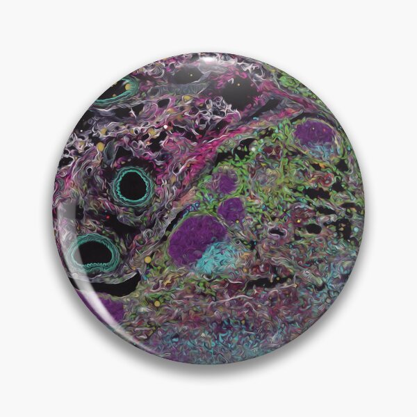 Item preview, Rainbow of infection: Lymph node with an abscess designed and sold by DreamingBeetle.