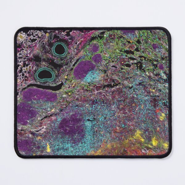 Item preview, Rainbow of infection: Lymph node with an abscess designed and sold by DreamingBeetle.