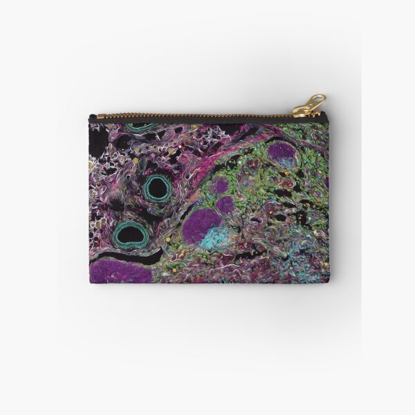 Item preview, Rainbow of infection: Lymph node with an abscess designed and sold by DreamingBeetle.