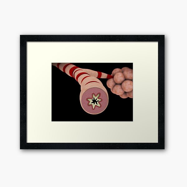 Item preview, STK701318H-An asthmatic bronchiole. designed and sold by StocktrekImages.