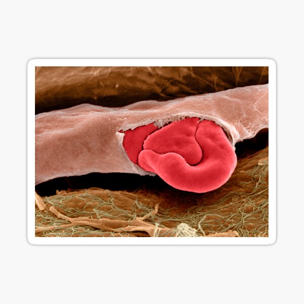 Item preview, Ruptured capillary, SEM (P212/0043) designed and sold by SciencePhoto.