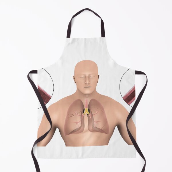 Item preview, STK701321H-Bronchitis in human lungs. designed and sold by StocktrekImages.