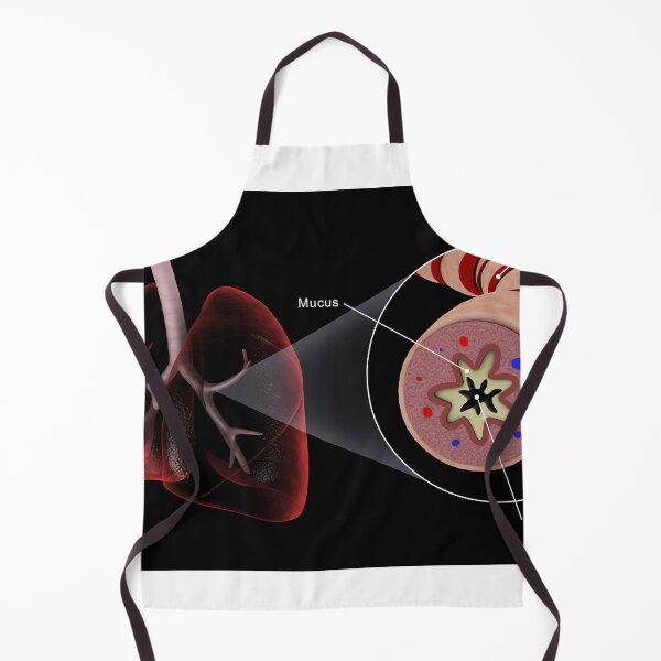 Item preview, STK701324H-An asthmatic bronchiole in the human lungs. designed and sold by StocktrekImages.