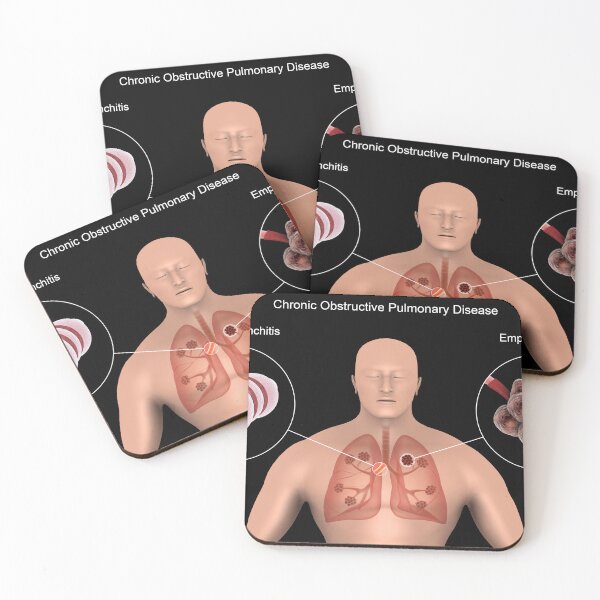 Item preview, STK701325H-Chronic Obstructive Pulmonary Disease (COPD). designed and sold by StocktrekImages.