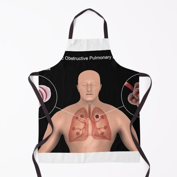 Item preview, STK701325H-Chronic Obstructive Pulmonary Disease (COPD). designed and sold by StocktrekImages.