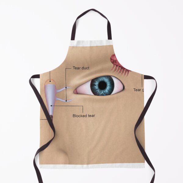 Item preview, STK701346H-Vlocked tear ducts in the human eye. designed and sold by StocktrekImages.